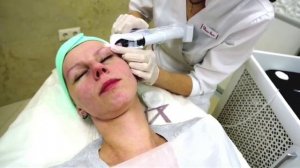 Инъекционная карбокситерапия