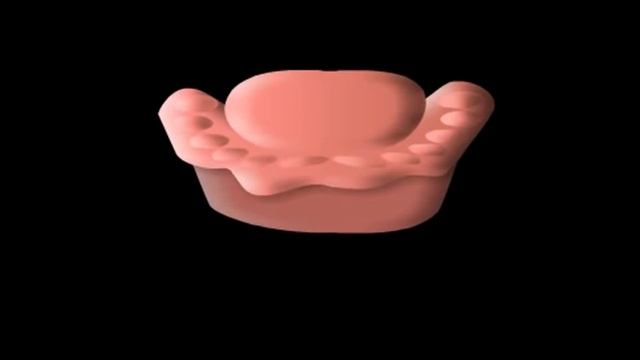 Какие мы допускаем ошибки при снятии оттиска? смотреть онлайн