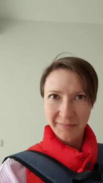 Результат спустя 5.5 месяцев после пересадки волос.