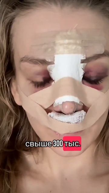 Косметические операции в Турции и Иране #новости #рино смотреть онлайн