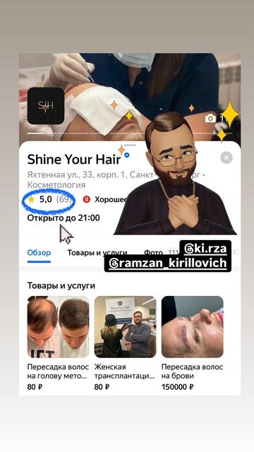 Доверяйте профессионалам! Пересадка волос в России! #б смотреть онлайн