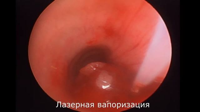 Трахеобронхоскопия у собки