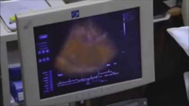 Прикол на узи смотреть онлайн