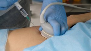 Хронотрон. Техника внутрисуставной инъекции в тазобедренный сустав под контролем УЗИ.