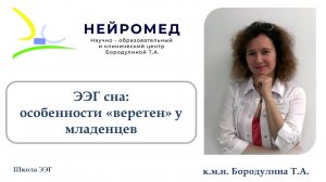 Школа ЭЭГ. ЭЭГ сна: особенности «веретен» у младенцев.