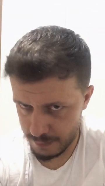 Пересадка волос до и после #shorts смотреть онлайн