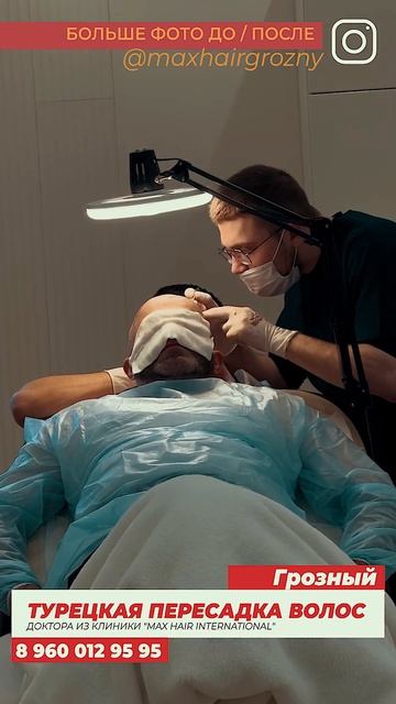 Турецкая пересадка волос в городе Грозный тел: 8960 012 95 9 смотреть онлайн