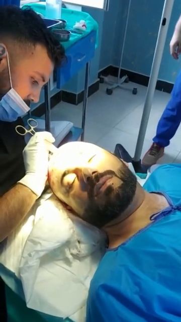 Пересадка волос #shorts