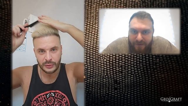 Пересадка волос | GeoGraft | отзыв от 07.11.2024г. смотреть онлайн