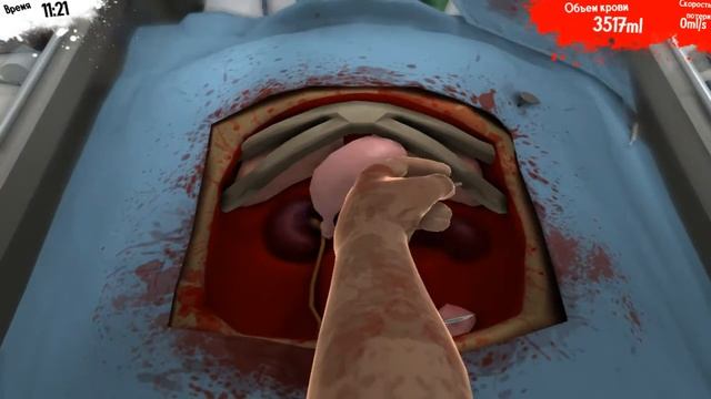SURGEON SIMULATOR Прохождение.Две операции.#2 смотреть онлайн