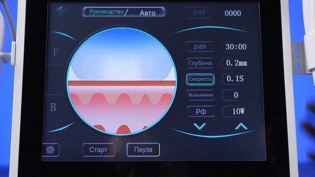Smas HIFU 4D для подтяжки и лифтинга смотреть онлайн