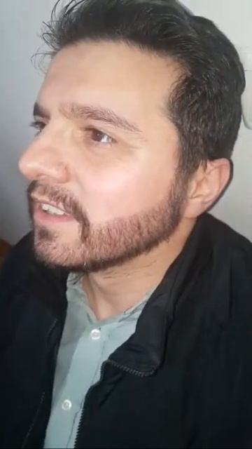 Пересадка бороды в Bellus Clinic. #барбер #пересадкабороды