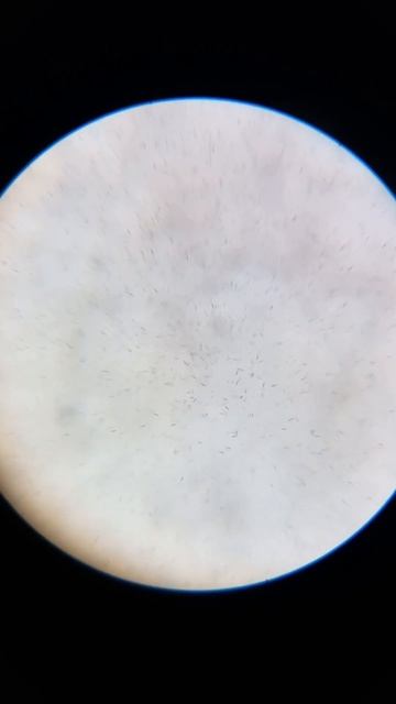 Семя хряка Пьетрен макстер под микроскопом. смотреть онлайн