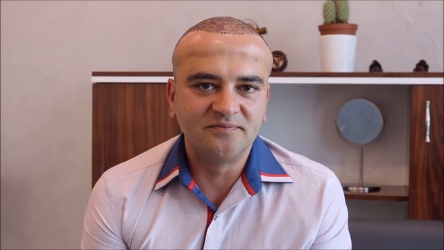 Присаждане на коса в Истанбул