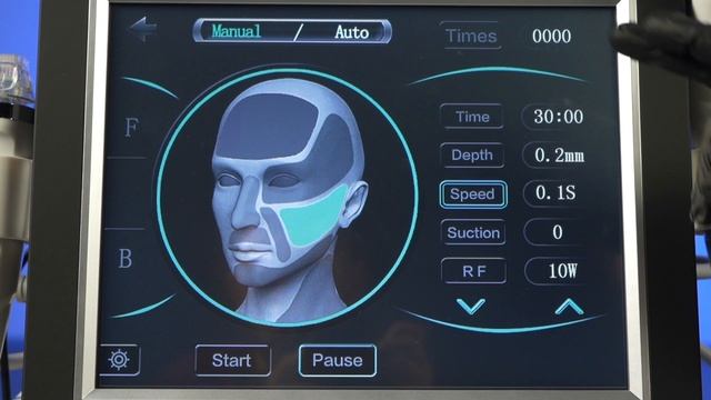 SMAS 4D HIFU для подтяжки и микроигольчатый RF для лифтинга смотреть онлайн