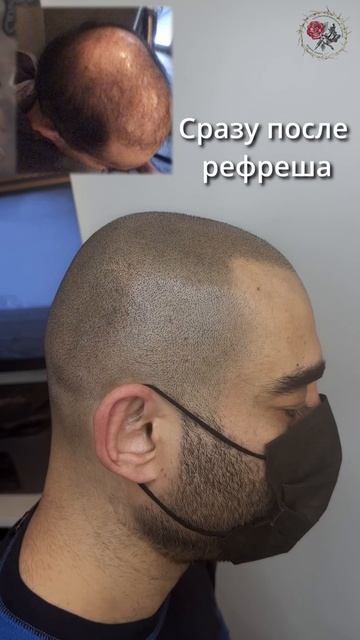 Трихопигментация до и после обновления цвета. Лучше ч?