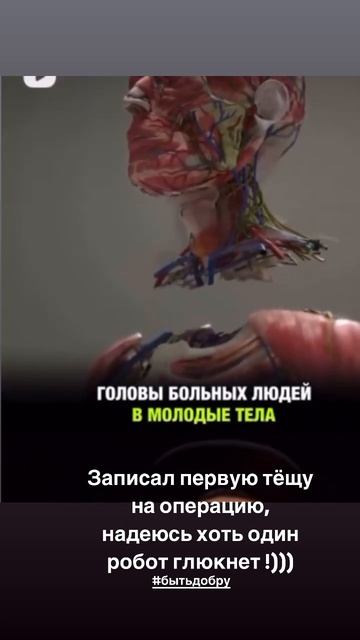 #бытьдобру первый в мире робот для пересадки головы на