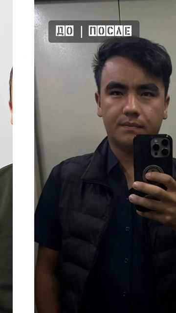 ⚡️ 3000 графт 1 йиллик натижа. #shorts #результаты смотреть онлайн