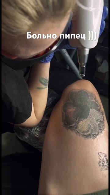 #лазерноеудалениетатуажа #удалениетату #боль #юмор #смех #тату #tattoo #приколы #жизненныеистории смотреть онлайн