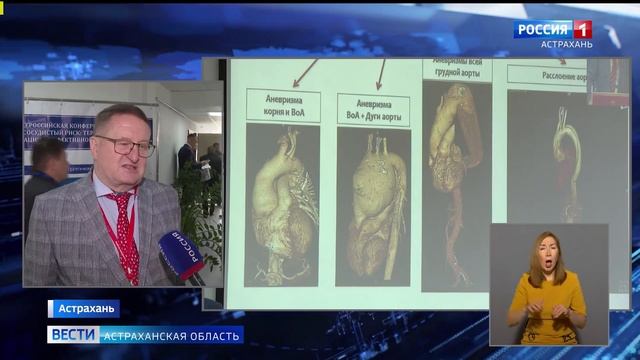 Сюжет от ГТРК Лотос Россия 1 о Каспийских встречах смотреть онлайн