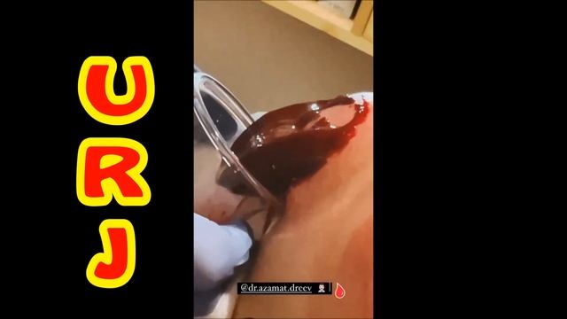 ТРАВМА ЧОРШАНБЕ! ЭТО ВИДЕО ДЛЯ ТЕХ КТО НЕ ВЕРИЛ В ТРАВМЕ ЧОРШАНБЕ ЧОРШАНБИЕВА! ВОТ ВАМ !