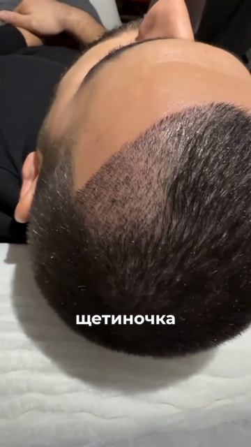 Так выглядит донорская зона на 16 день смотреть онлайн