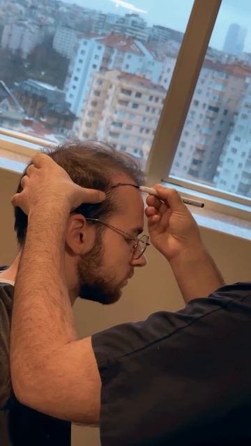 Трансплантация волос в Турции - хорошие отзывы #переса смотреть онлайн