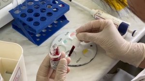 Определение группы крови (AB0) и резус фактора (Rh)