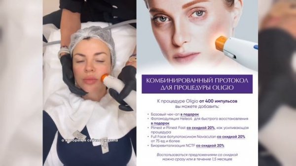 Аппарат Oligio