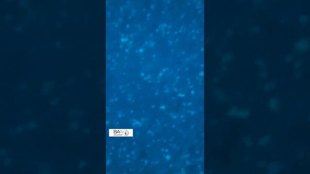 Разбор протокола микропигментации кожи головы SMP. #три