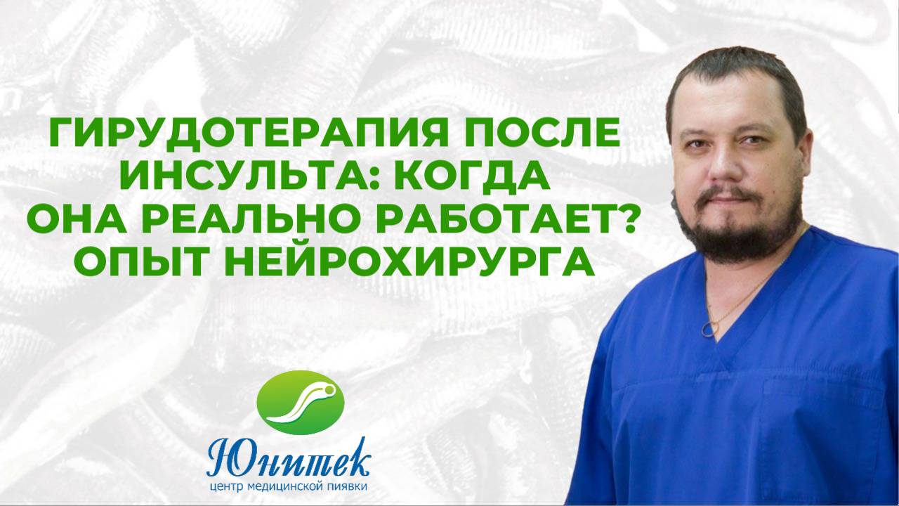 Гирудотерапия после инсульта: когда она реально работает?