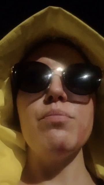 Прогулка ночью после пересадки кожи 2. #кислотныйманья смотреть онлайн