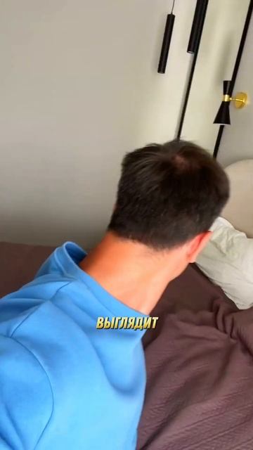 ОТЗЫВ ПЕРЕСАДКА ВОЛОС #148 смотреть онлайн