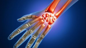 1 часть ГИМНАСТИКА  ПРИ ПЕРЕЛОМЕ ЛУЧЕЗАПЯСТНОГО СУСТАВА
#гимнастика #перелом