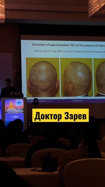 Doctor Zarev. Доктор Зарев. World FUE Institute #KRASAV4IK смотреть онлайн
