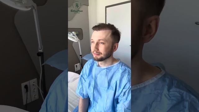 Результат пересадки волос после пересадки 5.500 графтов смотреть онлайн