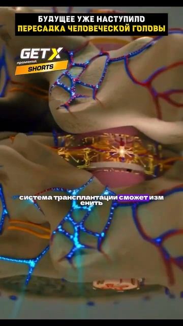Пересадка человеческой головы! Будущее уже наступило смотреть онлайн