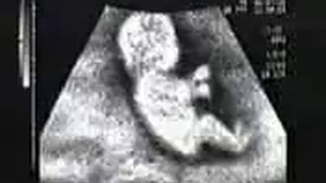 УЗИ прикол смотреть онлайн