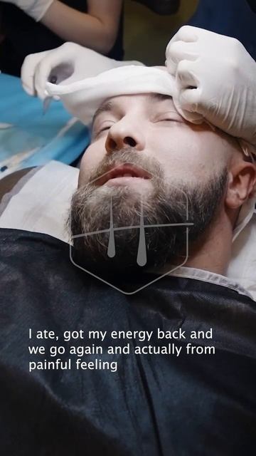 Healstetic | Как протекает процесс трансплантации волос? #hai смотреть онлайн