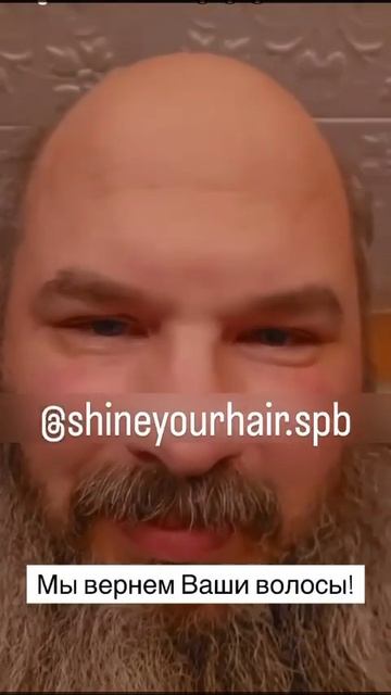 Пересадка волос в России. Хватит издеваться над детьм?