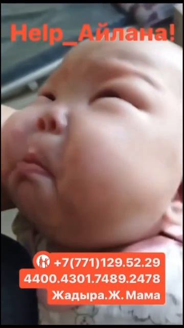 Диагноз;Врожденный нефротический синдром с мутацей г? смотреть онлайн