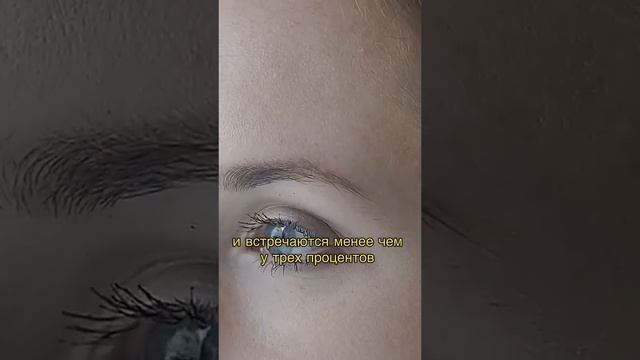 Самые редкие цвета глаз в мире #интересныефакты смотреть онлайн