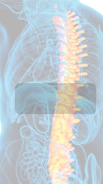 Endoscopic Spine Surgery | Dr. Nileaysh Patil | Althea Clinic | Pune смотреть онлайн