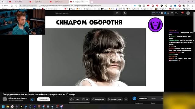 СТИНТ СМОТРИТ: Все редкие болезни, которые сделают вас смотреть онлайн