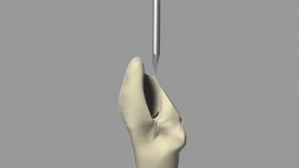 Эндопротезирование тазобедренного сустава у собаки