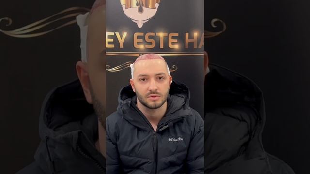 Пересадка волос после отлично операции #пересадкавол?