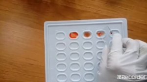 Определение группы крови и резус фактора