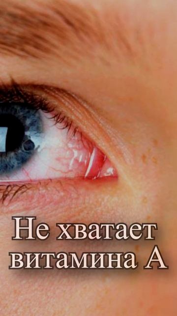 Как понять что организму не хватает витамин А смотреть онлайн