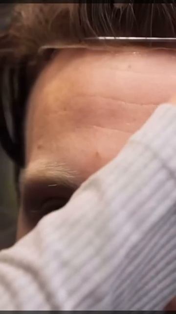 Не пересадка #красноярск #системаволос #пересадкаволо