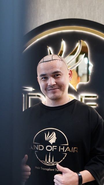 ✨ Лучший центр трансплантации волос в Алматы ✨ #краси